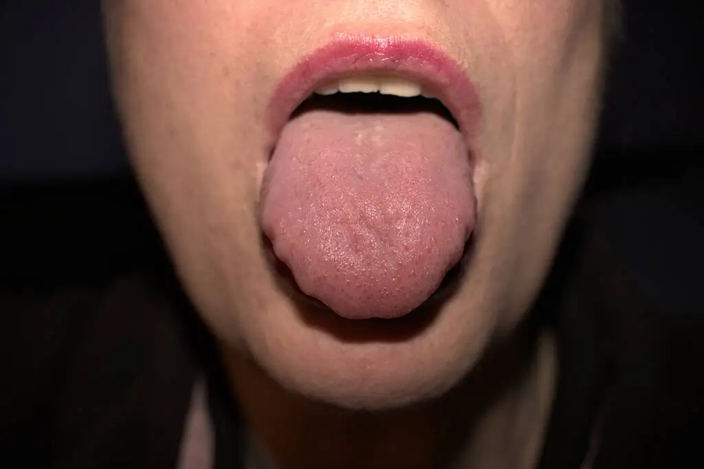 Bump Inside the Tongue 